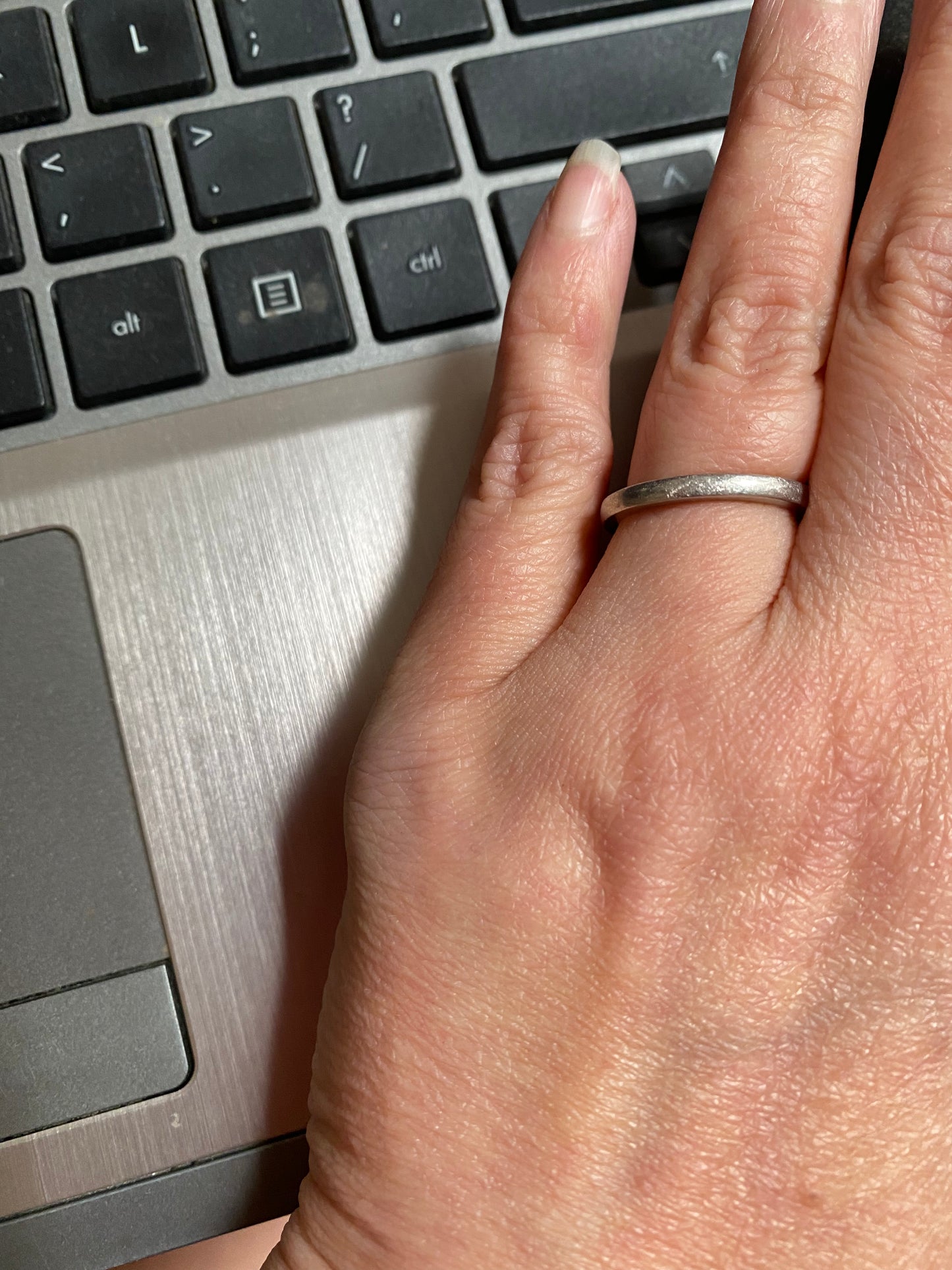 arnica bump and bruise cream01